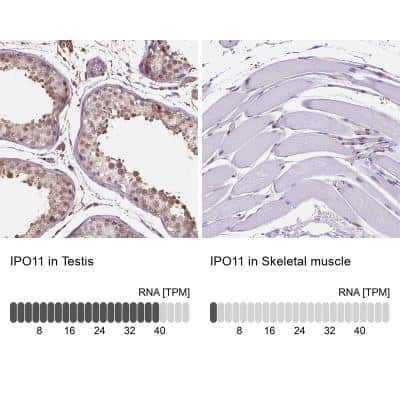 Immunohistochemistry-Paraffin: Importin 11 Antibody [NBP2-49505] - Analysis in human testis and skeletal muscle tissues. Corresponding RNA-seq data are presented for the same tissues.