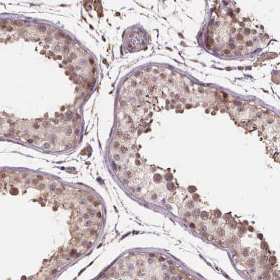 Immunohistochemistry-Paraffin: Importin 11 Antibody [NBP2-49505] - Staining of human testis shows moderate cytoplasmic positivity in cells in seminiferous ducts.