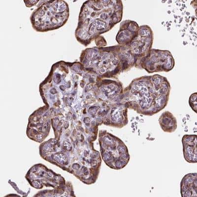 Immunohistochemistry-Paraffin: Importin 11 Antibody [NBP2-49505] - Staining of human placenta shows moderate cytoplasmic positivity in trophoblastic cells.