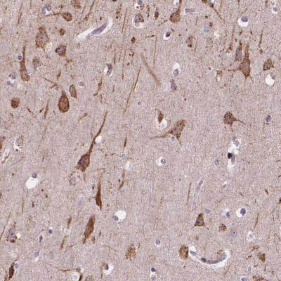 Immunohistochemistry-Paraffin: Importin 11 Antibody [NBP2-49505] - Staining of human cerebral cortex shows moderate cytoplasmic positivity in neurons.