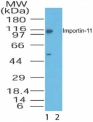 Western Blot: Importin 11 Antibody [NB100-56484] - Analysis of Importin-11 in HeLa lysate in the 1) absence and 2) presence of immunizing peptide using this antibody at 1 ug/ml.