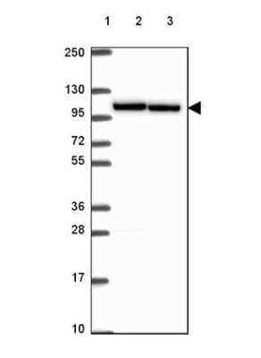 <b>Orthogonal Strategies Validation. </b>Western Blot: Importin 11 Antibody [NBP2-49505] - Lane 1: Marker [kDa] 250, 130, 95, 72, 55, 36, 28, 17, 10Lane 2: Human cell line RT-4 Lane 3: Human cell line U-251 MG