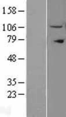 Western Blot: Importin 11 Overexpression Lysate (Adult Normal) [NBL1-12014] Left-Empty vector transfected control cell lysate (HEK293 cell lysate); Right -Over-expression Lysate for Importin 11.