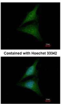 Immunocytochemistry/Immunofluorescence: Importin-13 Antibody [NBP2-14994] - Analysis of methanol-fixed HeLa, using antibody at 1:200 dilution.