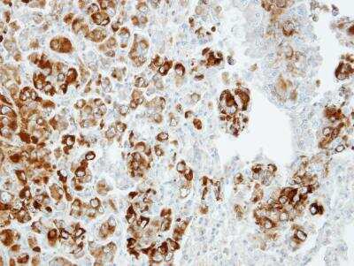 Immunohistochemistry-Paraffin: Importin-13 Antibody [NBP1-31508] -  CL1-5 xenograft, using Importin 13 antibody at 1:100 dilution. Antigen Retrieval: Trilogy™ (EDTA based, pH 8.0) buffer, 15min. 