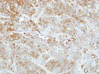 Immunohistochemistry-Paraffin: Importin-13 Antibody [NBP2-14994] - Paraffin-embedded MCF7 xenograft, using antibody at 1:500 dilution.