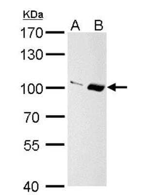 Western Blot: Importin-13 Antibody [NBP1-31508] - A. 30 ug PC-12 whole cell lysate/extract  B. 30 ug Rat2 whole cell lysate/extract 7.5 % SDS-PAGE Importin 13 antibody [C3], C-term dilution: 1:1000