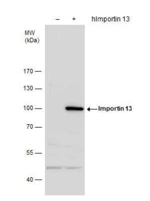 Western Blot: Importin-13 Antibody [NBP2-14994] - . Non-transfected (-) and Importin 13-transfected (+, ) 293T whole cell extracts (30 ug) were separated by 7.5% SDS-PAGE, and the membrane was blotted with Importin 13 antibody diluted by 1:1000.