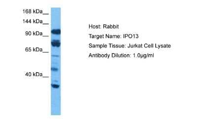 Western Blot: Importin-13 Antibody [NBP2-86677] - Host: Rabbit. Target Name: IPO13. Sample Tissue: Human Jurkat Whole Cell. Antibody Dilution: 1.0ug/ml