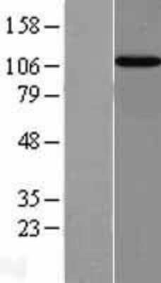 Western Blot: Importin-13 Overexpression Lysate (Adult Normal) [NBL1-12015] Left-Empty vector transfected control cell lysate (HEK293 cell lysate); Right -Over-expression Lysate for Importin-13.