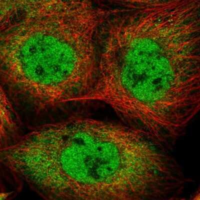 Immunocytochemistry/Immunofluorescence: Importin-7 Antibody [NBP2-56778] - Staining of human cell line A-431 shows localization to nucleoplasm & cytosol.