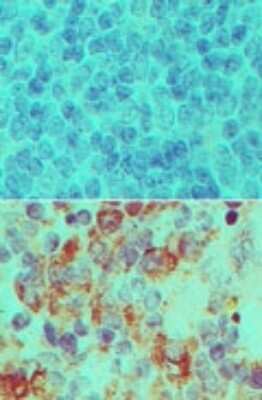 Immunohistochemistry-Paraffin Importin-7 Antibody