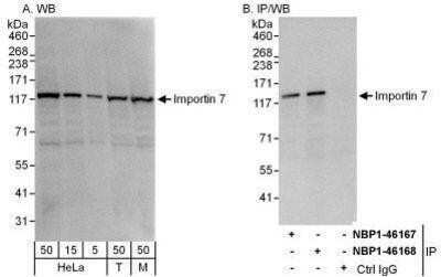 Western Blot: Importin-7 Antibody [NBP1-46168] - Whole cell lysate from HeLa (5, 15 and 50 mcg for WB; 1 mg for IP, 20% of IP loaded), 293T (T; 50 mcg), and mouse NIH3T3 (M; 50 mcg) cells.   Affinity purified rabbit anti-Importin 7 antibody used for WB at 0.04 mcg/ml (A) and 0.1 mcg/ml (B) and used for IP at 10 mcg/mg lysate.  Importin 7 was also immunoprecipitated by rabbit anti-Importin 7 antibody NBP1-46167, which recognizes an upstream epitope.