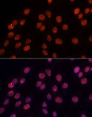 Immunocytochemistry/Immunofluorescence: Importin-8 Antibody [NBP3-03821] - Analysis of C6 cells using Importin-8 antibody at dilution of 1:100. Blue: DAPI for nuclear staining.