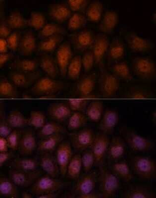 Immunocytochemistry/Immunofluorescence: Importin-8 Antibody [NBP3-03821] - Analysis of HeLa cells using Importin-8 antibody at dilution of 1:100. Blue: DAPI for nuclear staining.