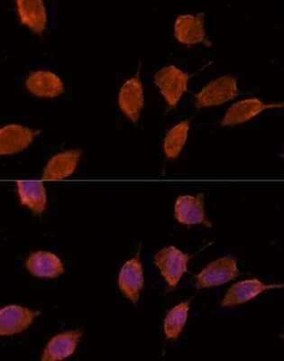 Immunocytochemistry/Immunofluorescence: Importin-8 Antibody [NBP3-03821] - Analysis of L929 cells using Importin-8 antibody at dilution of 1:100. Blue: DAPI for nuclear staining.