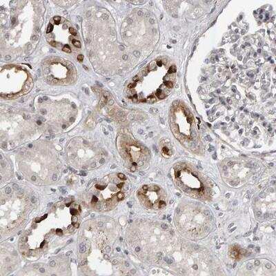 Immunohistochemistry-Paraffin: Importin-8 Antibody [NBP1-87878] - Staining of human kidney shows strong cytoplasmic positivity in subsets of cells.