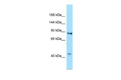 Western Blot: Importin-8 Antibody [NBP2-87625] - WB Suggested Anti-IPO8 Antibody. Titration: 1.0 ug/ml. Positive Control: Fetal Kidney