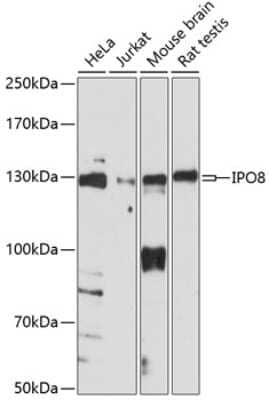 Western Blot: Importin-8 Antibody [NBP3-03821] - Analysis of extracts of various cell lines, using Importin-8 antibody at 1:1000 dilution. Secondary antibody: HRP Goat Anti-Rabbit IgG (H+L) at 1:10000 dilution. Lysates/proteins: 25ug per lane. Blocking buffer: 3% nonfat dry milk in TBST.