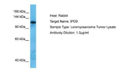 Western Blot: Importin-9 Antibody [NBP2-86679] - Host: Rabbit. Target Name: IPO9. Sample Tissue: Human Leiomyosarcoma Tumor lysates. Antibody Dilution: 1ug/ml