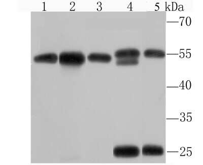 Western Blot: Importin alpha 2/KPNA2 Antibody (JM90-33) [NBP2-75543] - Analysis of KPNA2 on different cell lysates using anti-KPNA2 antibody at 1/1,000 dilution.Postive control:Lane 1: Hela          Lane 2: 293TLane 3: HepG2         Lane 4: NIH-3T3Lane 5: PC-12