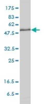 Western Blot: Importin alpha 5/KPNA1/SRP1 Antibody (2A4-1B5) [H00003836-M01] - KPNA1 monoclonal antibody (M01), clone 2A4-1B5 Analysis of KPNA1 expression in HeLa.