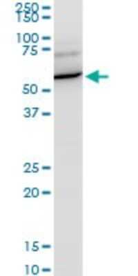 Western Blot: Importin alpha 5/KPNA1/SRP1 Antibody [H00003836-A02] - Analysis of KPNA1 expression in PC-12.