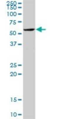 Western Blot: Importin alpha 5/KPNA1/SRP1 Antibody [H00003836-D01P] - Analysis of KPNA1 expression in human placenta.