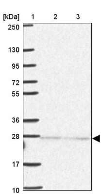 Western Blot Importin alpha 5/KPNA1/SRP1 Antibody