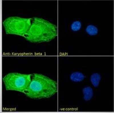 Immunocytochemistry/Immunofluorescence: Importin beta/KPNB1 Antibody [NB100-40784] - Immunofluorescence analysis of paraformaldehyde fixed U2OS cells, permeabilized with 0.15% Triton. Primary incubation 1hr (10 ug/mL) followed by Alexa Fluor 488 secondary antibody (2 ug/mL), showing nuclear membrane, nuclear and cytoplasmic staining. The nuclear stain is DAPI (blue). Negative control: Unimmunized goat IgG (10 ug/mL) followed by Alexa Fluor 488 secondary antibody (2 ug/mL).