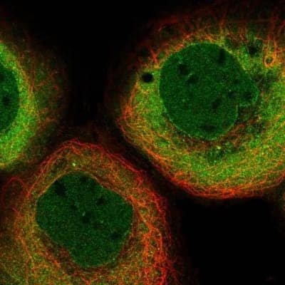 Immunocytochemistry/Immunofluorescence: Importin beta/KPNB1 Antibody [NBP1-87712] - Staining of human cell line A-431 shows localization to nucleoplasm, nuclear membrane & cytosol. Antibody staining is shown in green.