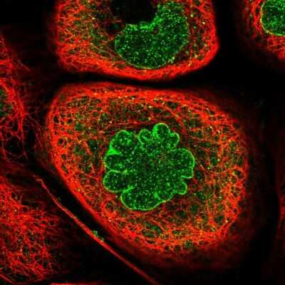 Immunocytochemistry/Immunofluorescence: Importin beta/KPNB1 Antibody [NBP2-55641] - Staining of human cell line A-431 shows localization to nucleoplasm, nuclear membrane & cytosol.