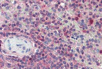 Immunohistochemistry-Paraffin: Importin beta/KPNB1 Antibody [NB100-40784] - Staining of paraffin embedded Human Spleen with antibody at 5 ug/mL. Steamed antigen retrieval with citrate buffer pH 6, AP-staining.