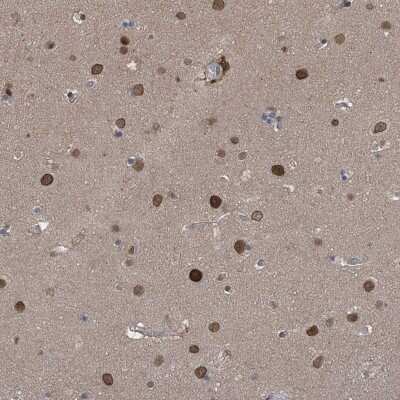 Immunohistochemistry-Paraffin: Importin beta/KPNB1 Antibody [NBP1-87712] - Staining of human cerebral cortex shows moderate to strong nuclear and nuclear membrane positivity in neurons.