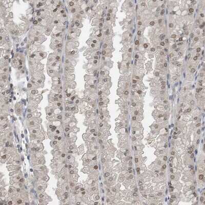 Immunohistochemistry-Paraffin: Importin beta/KPNB1 Antibody [NBP1-87712] - Staining of human stomach shows moderate nuclear and nuclear membrane positivity in glandular cells.