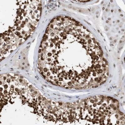 Immunohistochemistry-Paraffin: Importin beta/KPNB1 Antibody [NBP1-87712] - Staining of human testis shows moderate to strong nuclear and nuclear membrane positivity in cells in seminiferous ducts.