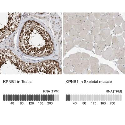 Immunohistochemistry-Paraffin: Importin beta/KPNB1 Antibody [NBP1-87712] - Staining in human testis and skeletal muscle tissues . Corresponding KPNB1 RNA-seq data are presented for the same tissues.