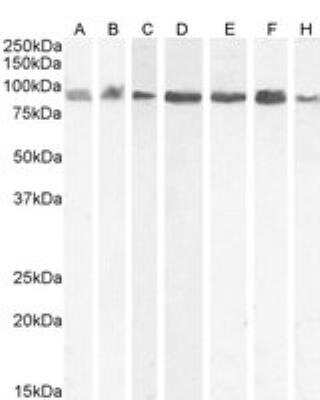 Western Blot: Importin beta/KPNB1 Antibody [NB100-40784] - Staining of A431 (A), HEK293 (B), Jurkat (C) cell lysates with antibody at 0.03 ug/mL, Daudi (D), HeLa (E) cell lysates with antibody at 0.01 ug/mL, and Kelly (F) and KNRK (G) cell lysate with antibody at 0.1 ug/mL (35 ug protein in RIPA buffer). Detected by chemiluminescence.