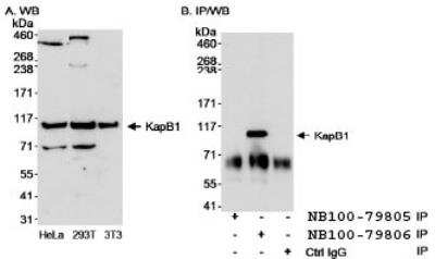 Western Blot: Importin beta/KPNB1 Antibody [NB100-79806] - Importin beta Antibody [NB100-79806] - Detection of KapB1 by Western Blot and  Immunoprecipitation. Samples: A. Whole cell lysate (50 mcg)  from HeLa, 293T and mouse 3T3 cells. B. Whole cell lysate (1  mg for IP, 1/4 of IP loaded/lane) from HeLa cells. Antibodies:  Affinity purified rabbit anti-KapB1 antibody BL1964 (Cat. No. NB100-79806) used at 0.1 mcg/ml for WB (A and B) and at 3  mcg/mg lysate for IP (B). Immunoprecipitation of KapB1 was  unsuccessful when using rabbit anti-KapB1 antibody BL1962  (Cat. No. NB100-79805) at 3 mcg/mg lysate. Detection:  Chemiluminescence with an exposure time of 30 seconds (A and  B).