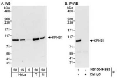 Western Blot: Importin beta/KPNB1 Antibody [NB100-94993] - Detection of Human and Mouse KPNB1 on HeLa whole cell lysate using NB100-94993.