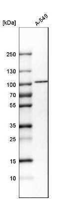 Western Blot: Importin beta/KPNB1 Antibody [NBP1-87712] - Analysis in human cell line A-549.