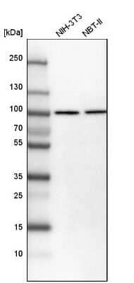 <b>Orthogonal Strategies Validation. </b>Western Blot: Importin beta/KPNB1 Antibody [NBP1-87712] - Analysis in mouse cell line NIH-3T3 and rat cell line NBT-II.