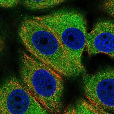 <b>Independent Antibodies Validation. </b>Immunocytochemistry/Immunofluorescence: Importin4 Antibody [NBP2-56986] - Staining of human cell line MCF7 shows localization to cytosol.