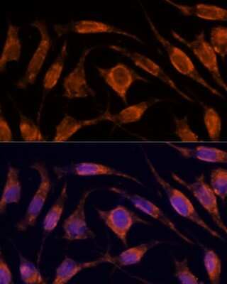 Immunocytochemistry/Immunofluorescence: Importin4 Antibody [NBP3-03794] - Analysis of L929 cells using Importin4 antibody at dilution of 1:100. Blue: DAPI for nuclear staining.