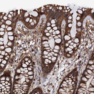 <b>Independent Antibodies Validation. </b>Immunohistochemistry-Paraffin: Importin4 Antibody [NBP1-89841] - Staining of human colon shows strong cytoplasmic positivity in glandular cells.