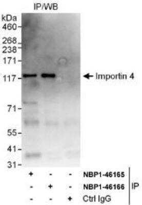 Immunoprecipitation: Importin4 Antibody [NBP1-46165] - Whole cell lysate (1 mg for IP, 20% of IP loaded) from HeLa cells.  Antibodies: Affinity purified rabbit anti-Importin 4 antibody used for IP at 10 mcg/mg lysate.  Importin 4 was also immunoprecipitated by rabbit anti-Importin 4 antibody NBP1-46166, which recognizes a downstream epitope.