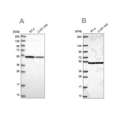 Western Blot: Importin4 Antibody [NBP1-89841] - Analysis using Anti-IPO4 antibody NBP1-89841 (A) shows similar pattern to independent antibody NBP2-56986 (B).