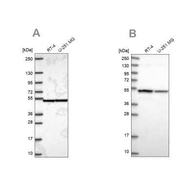 Western Blot: Importin4 Antibody [NBP2-56986] - Analysis using Anti-IPO4 antibody NBP2-56986 (A) shows similar pattern to independent antibody NBP1-89841 (B).