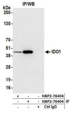 Western Blot: Indoleamine 2,3-dioxygenase/IDO Antibody (BLR040F) [NBP2-76408] - Detection of human IDO1 by WB of immunoprecipitates from HeLa lysate treated with IFN-gamma. Antibodies: Rabbit anti-IDO1 recombinant monoclonal [BLR040F] (NBP2-76408) and rabbit anti-IDO1 recombinant monoclonal [BLR031F] (NBP2-76404).