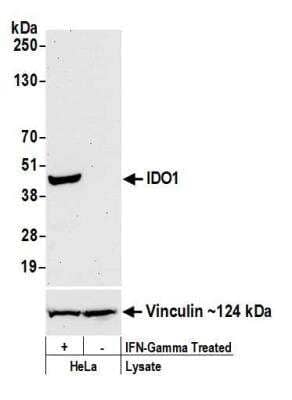 Western Blot: Indoleamine 2,3-dioxygenase/IDO Antibody (BLR040F) [NBP2-76408] - Detection of human IDO1 by WB of HeLa treated with IFN-gamma (+) or mock treated (-). Antibody: Rabbit anti-IDO1 recombinant monoclonal [BLR040F] (NBP2-76408). Secondary: HRP-conjugated goat anti-rabbit IgG. Lower Panel: Rabbit anti-Vinculin.